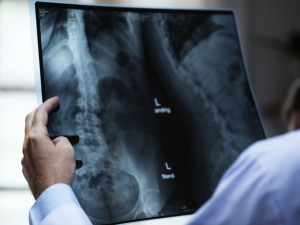 Nemocnice Náchod bude mít nová pracoviště rentgenu a ultrazvuku
