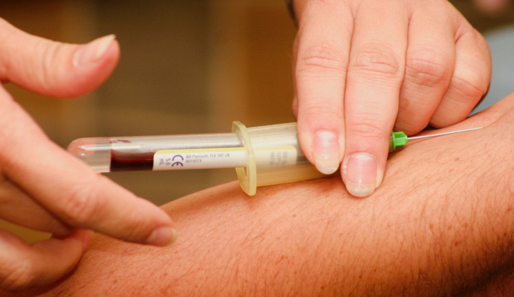 Česká společnost AIDS pomoc obnovila testování HIV v pevných CheckPointech