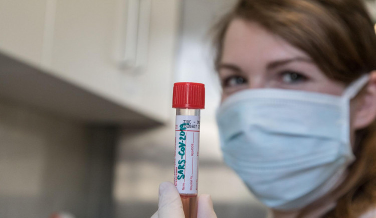 V Královéhradeckém kraji se vyléčilo skoro 85% nakažených. Máme nejméně nemocných v zemi