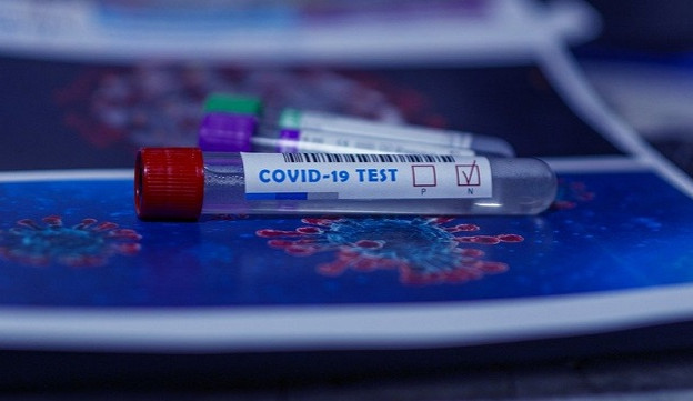 Za měsíc by mohl být na trhu společný test na chřipku a koronavir, výsledky přinese do hodiny