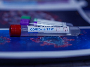 Za měsíc by mohl být na trhu společný test na chřipku a koronavir, výsledky přinese do hodiny