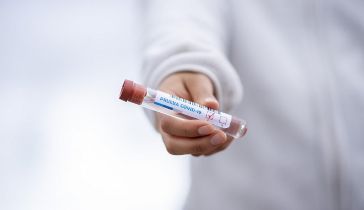 Testy v Domově U Biřičky prokázaly covid u více než 80 lidí