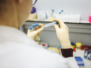 V ČR je zřejmě sedm podezření na jihoafrickou mutaci koronaviru. Dva z testovaných vzorků jsou z Trutnovska