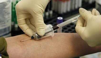 Odborníci hledají dobrovolníky do studie protilátek na covid-19