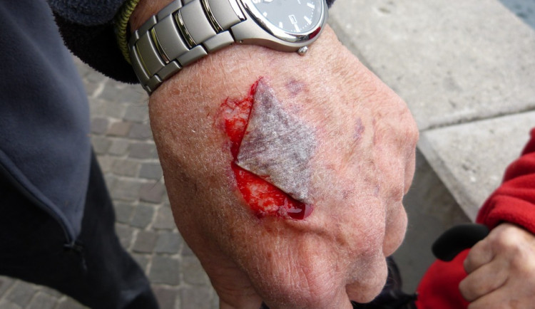 Žena v Hradci Králové pokousala tři policisty. Jednomu málem ukousla malíček
