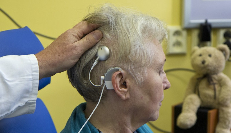 Fakultní nemocnice Hradec Králové implantovala stovku kochleárních implantátů. Lidem vrací sluch