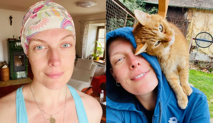 Po návratu z lyžování si mladá žena myslela, že má namoženou ruku. Z bolesti se vyklubala rakovina prsu