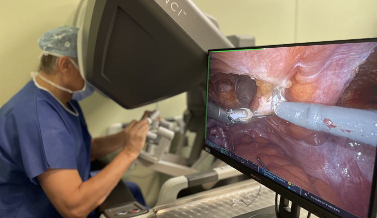 Robot v Jihlavě už rok operuje na chirurgii, gynekologii i urologii. Pomohl už dvěma stovkám pacientů