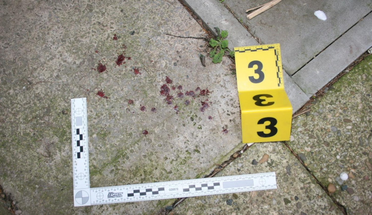 Dvojice mladíků napadla a okradla muže. Napadený skončil v nemocnici a přišel o 20 tisíc