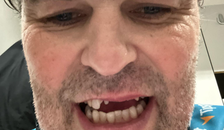Jaromír Jágr přišel v Hradci Králové o několik zubů