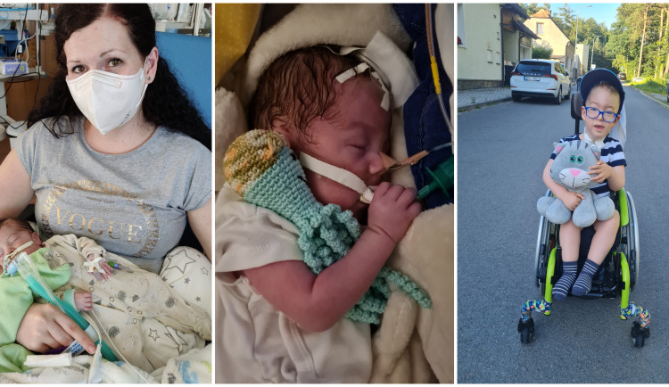 Lékaři mu dávali jen 90 dní života, dnes jsou Tedíkovi tři roky a dál statečně čelí vážné nemoci