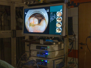 Hradecká nemocnice umí lépe diagnostikovat rakovinu střev. Pomáhají nové přístroje