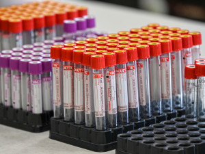 Hradecký kraj otevřel v Oblastní nemocnici Trutnov novou budovu laboratoří