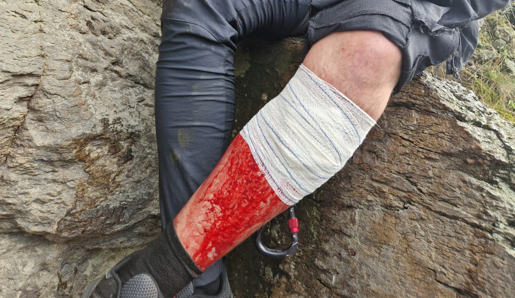 Po chvilce nepozornosti přišel bolestivý pád. Hasiči opět zasahovali na bechyňské ferratě