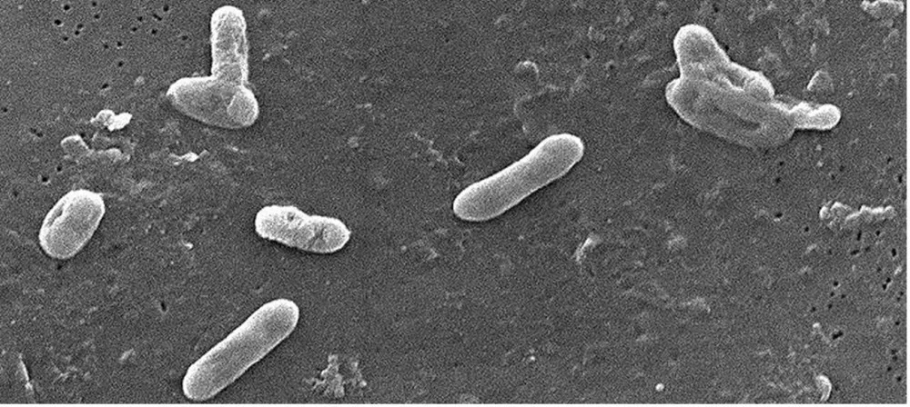 Bakterie Bordetella bronchiseptica jako původce psinkového kašle