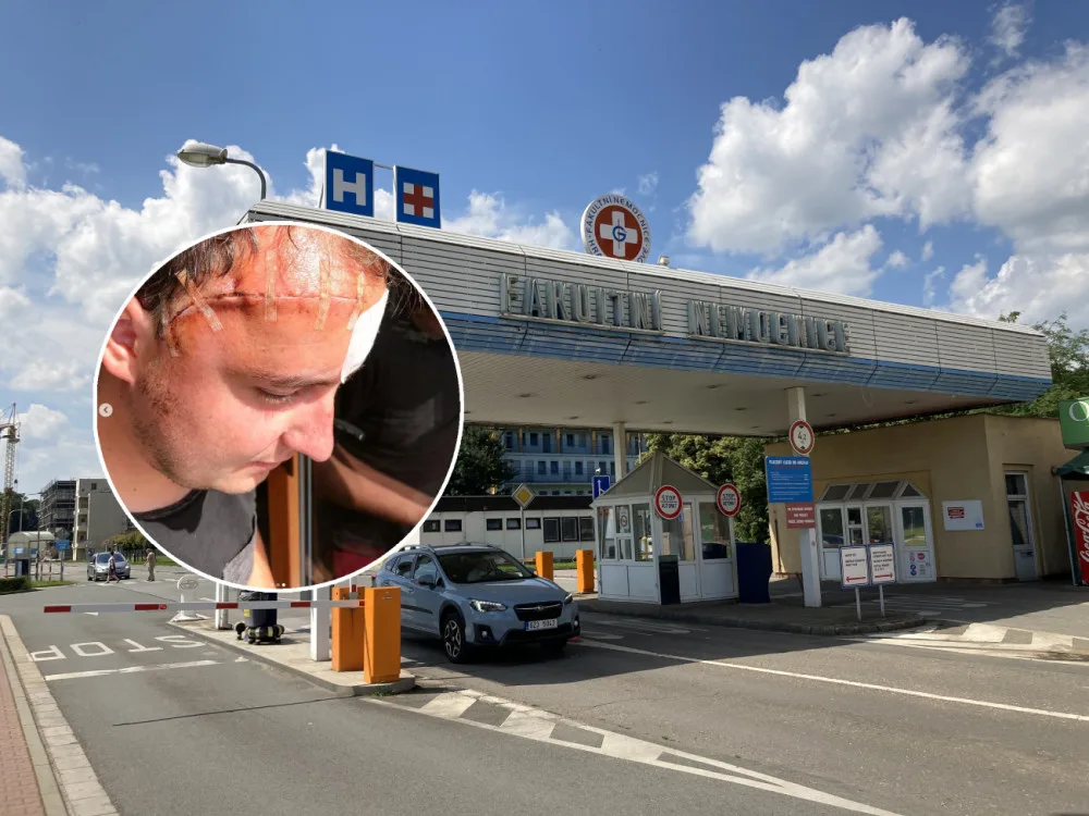 Hradecká neurochirurgická klinika slaví 70. výročí. Například Petr šel na sál náhodou, po skoku do bazénu
