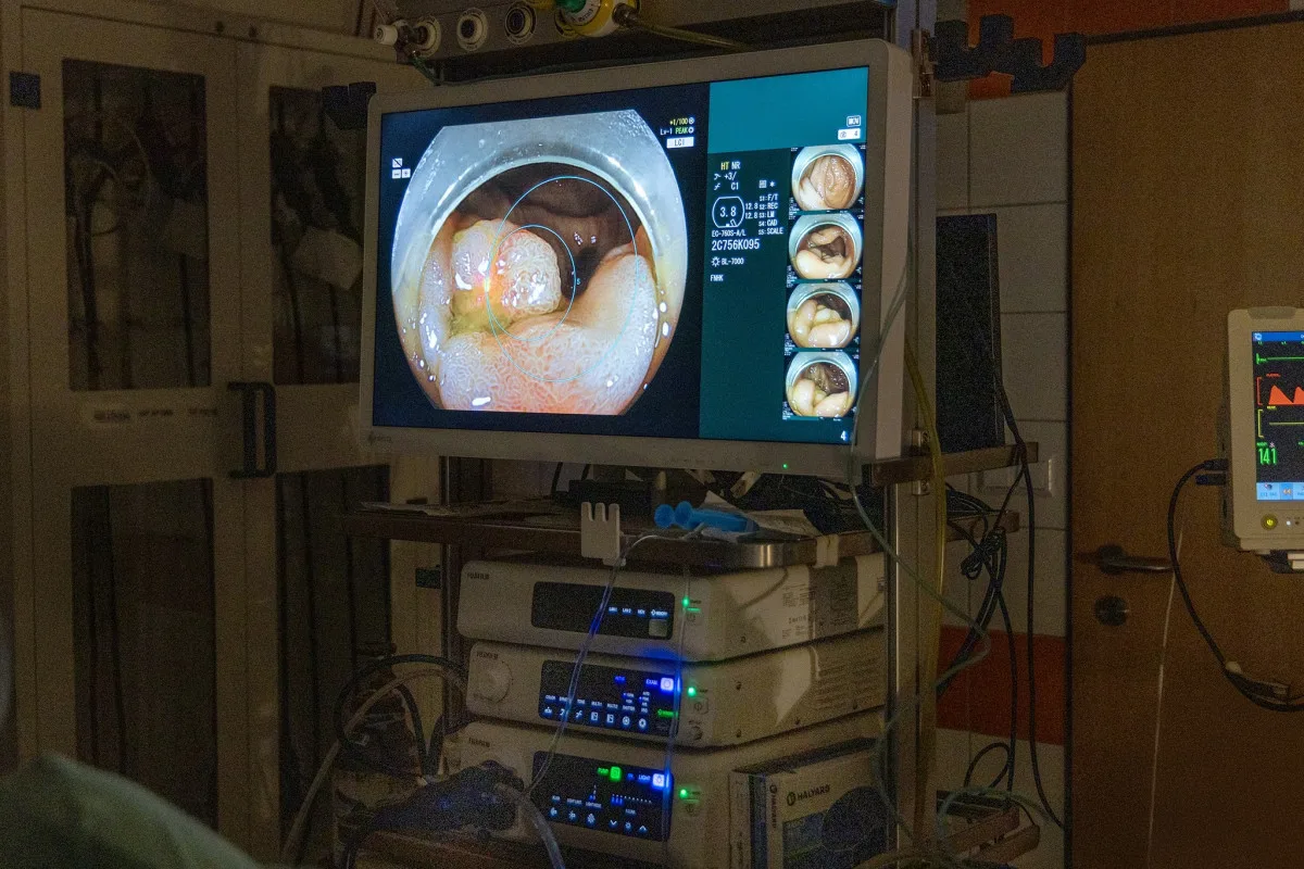 Hradecká nemocnice umí lépe diagnostikovat rakovinu střev. Pomáhají nové přístroje