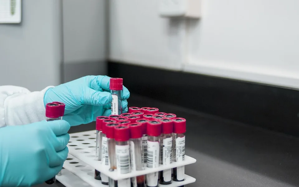 Laboratoř potvrdila první případ varianty omikron v Královéhradeckém kraji