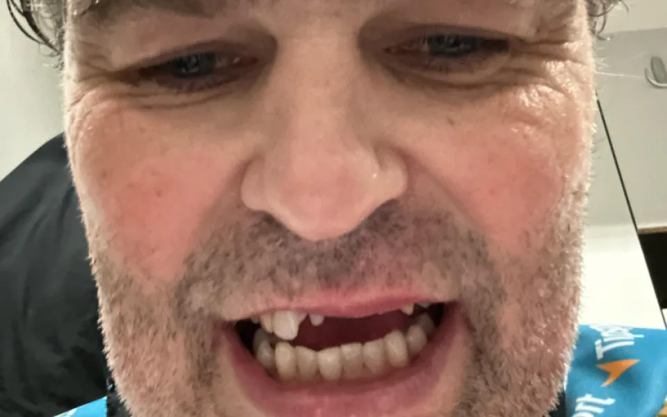 Jaromír Jágr přišel v Hradci Králové o několik zubů