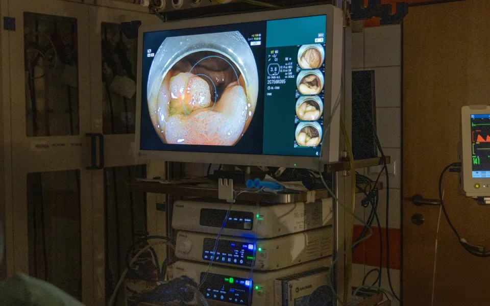 Hradecká nemocnice umí lépe diagnostikovat rakovinu střev. Pomáhají nové přístroje